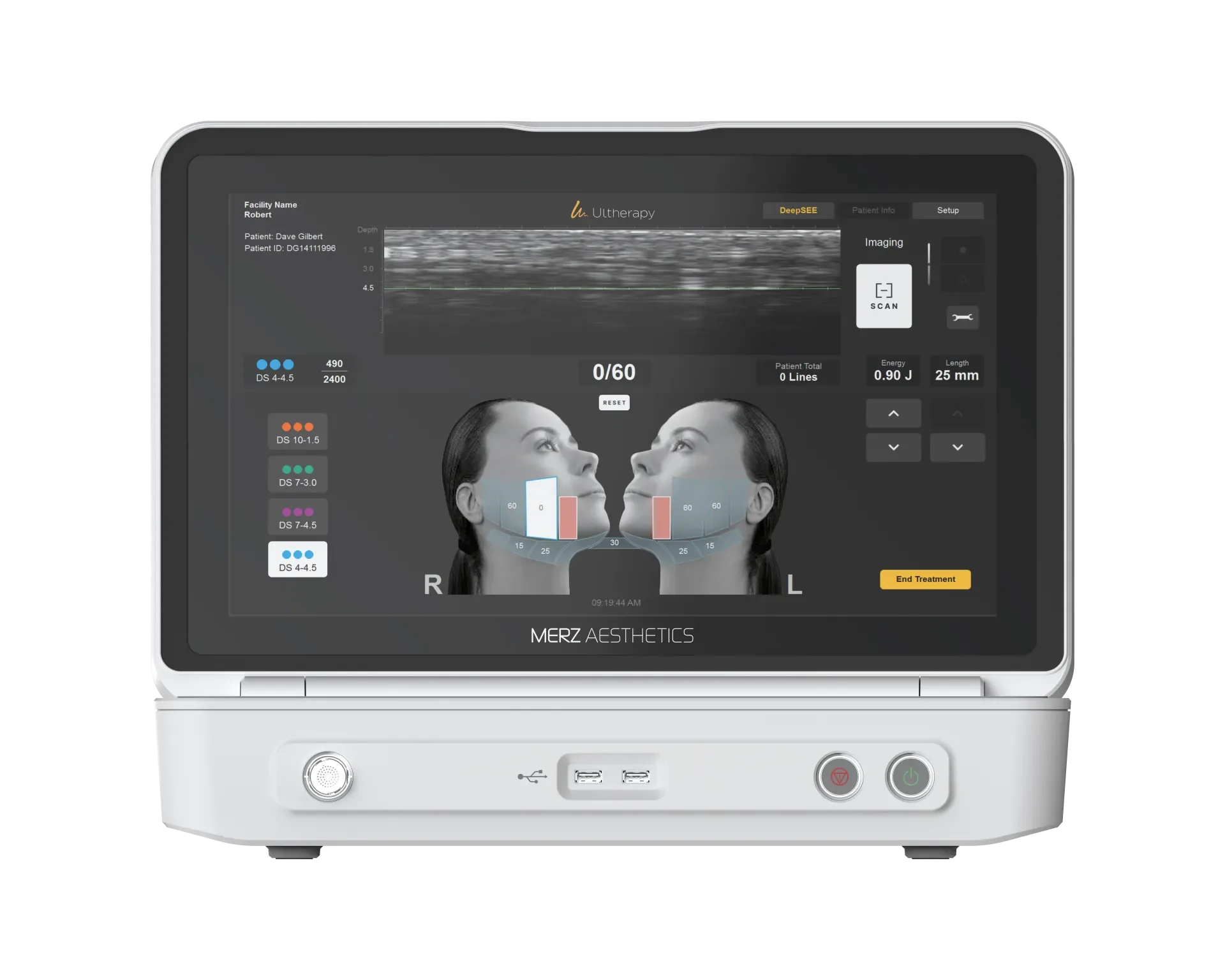 Korea Ultherapy — device imagery